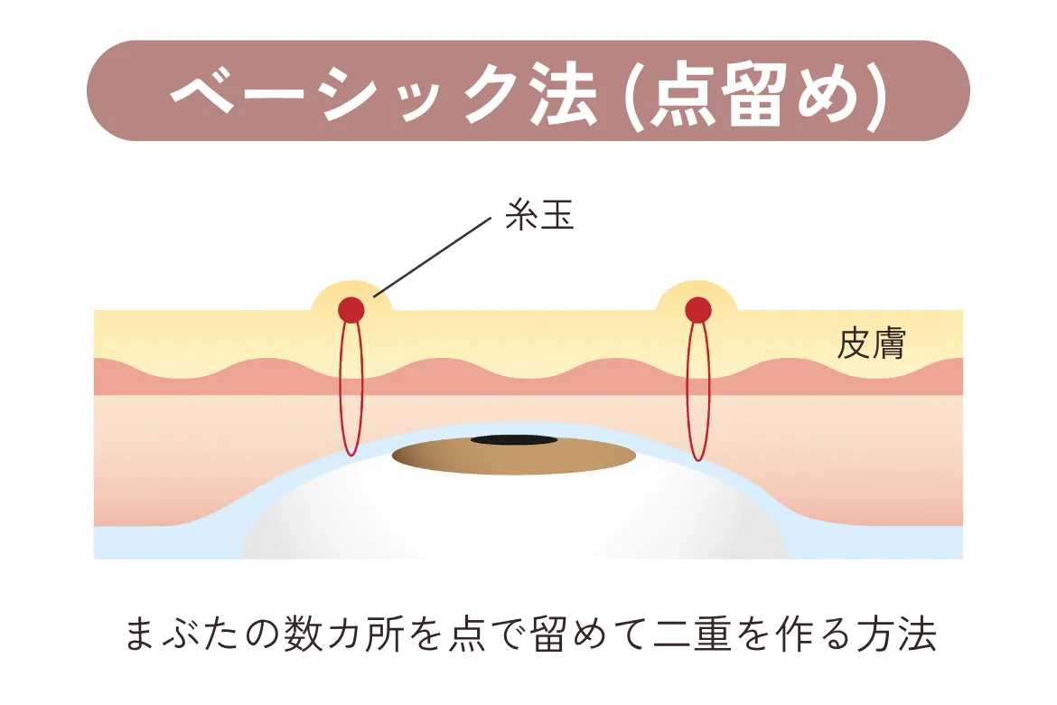 ベーシック法