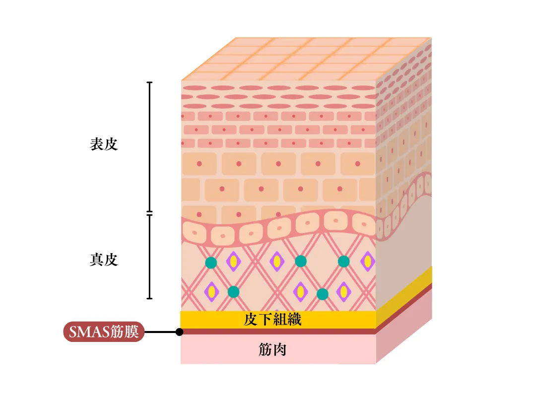HIFU（ハイフ）とは