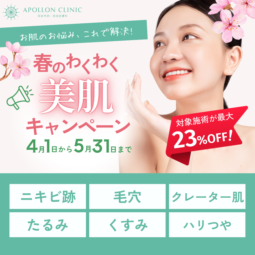 キャンペーン