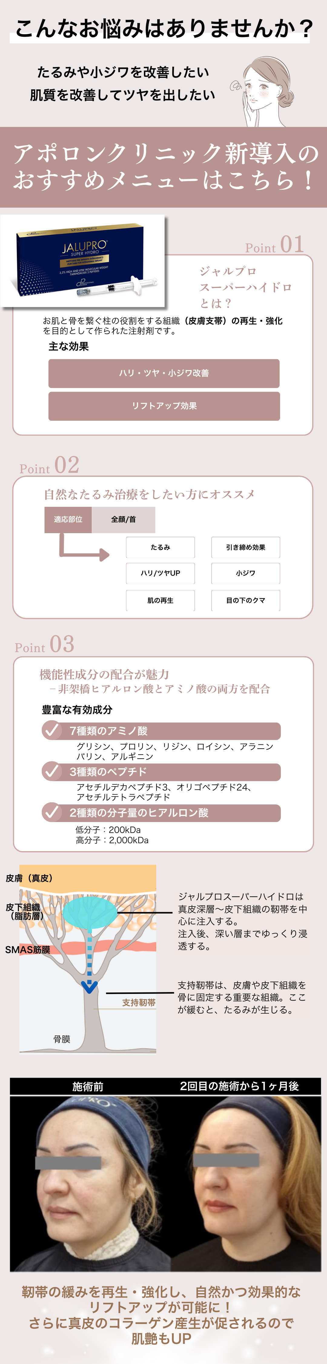 シワやたるみを根本から改善したい方へ！話題の若返り製剤『ジャルプロ』が33%OFF（4月1日〜5月31日までの期間限定）