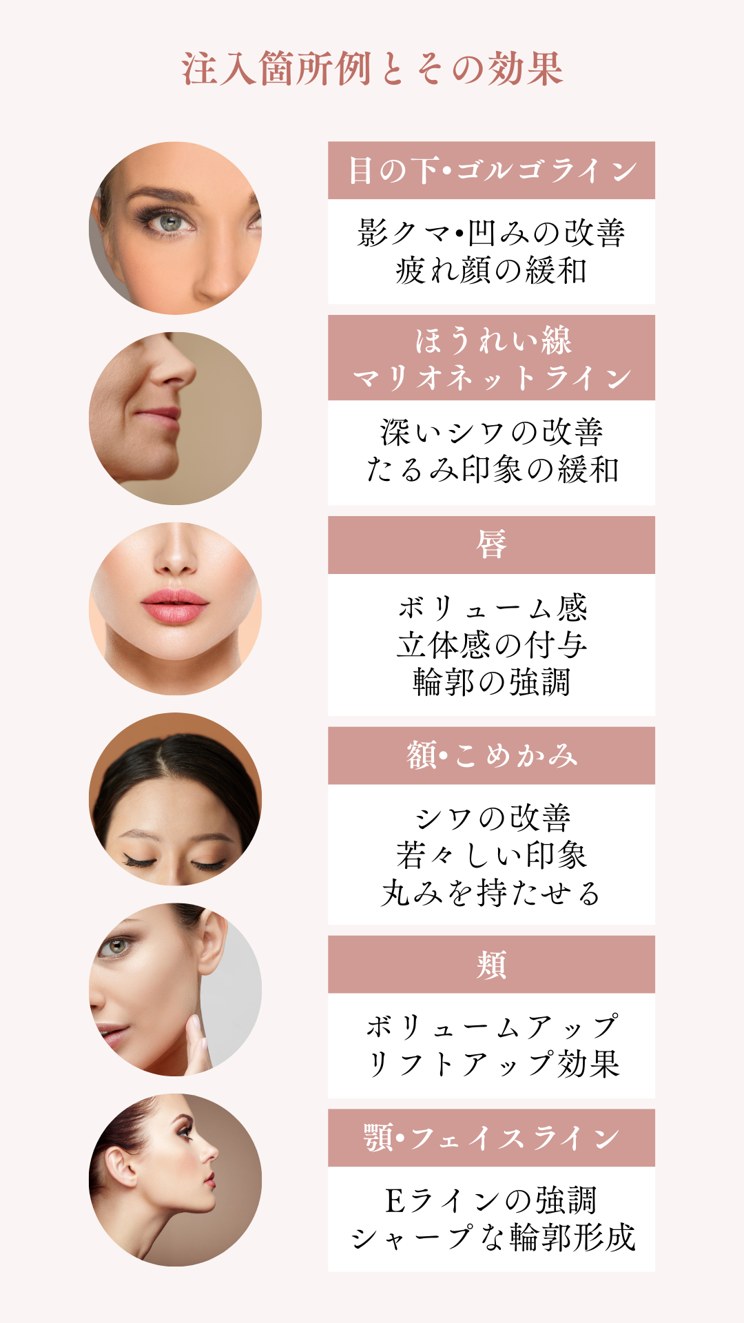 【1周年記念企画】アポロン式カスタマイズ注入で自然で若々しい仕上がりへ 今だけヒアルロン酸1cc¥55,000！