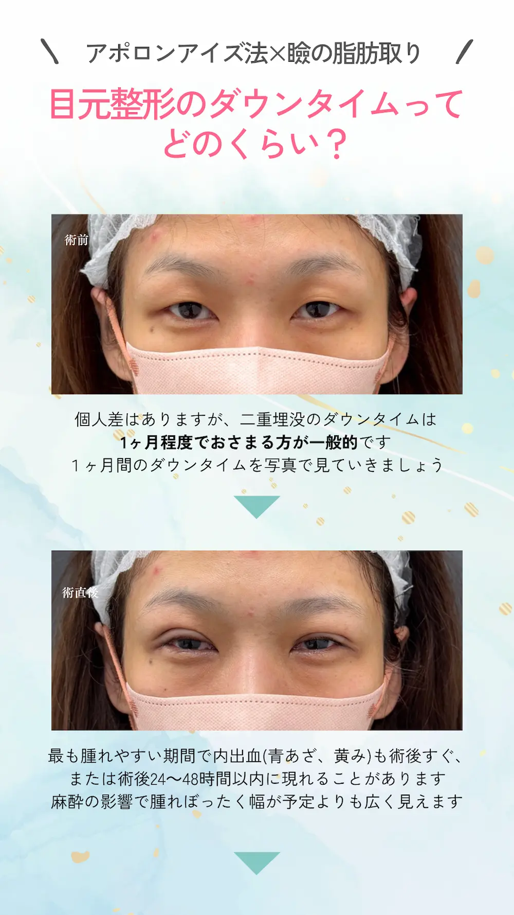 二重整形や目頭切開などの目元整形が最大40%OFF！長期休みを利用して『目元垢抜け』しませんか？（8月31日までの期間限定）