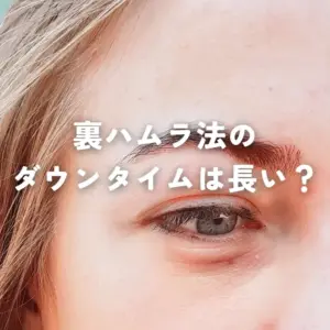 裏ハムラ法のダウンタイムは長い？