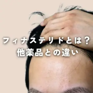 フィナステリドとは？他薬品との違い
