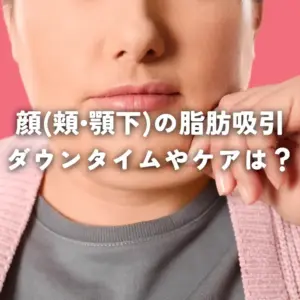 顔（頬・顎下）の脂肪吸引をした後のダウンタイムは？