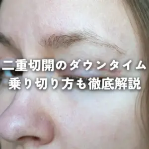 二重切開のダウンタイム乗り切り方も徹底解説