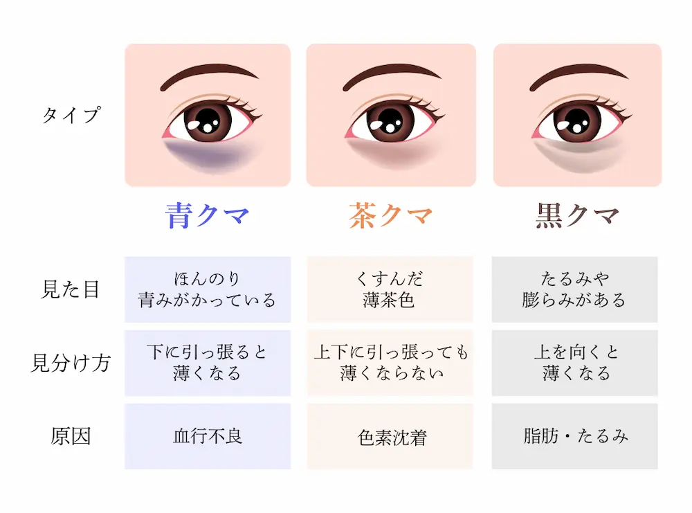 目の下のクマのタイプと原因