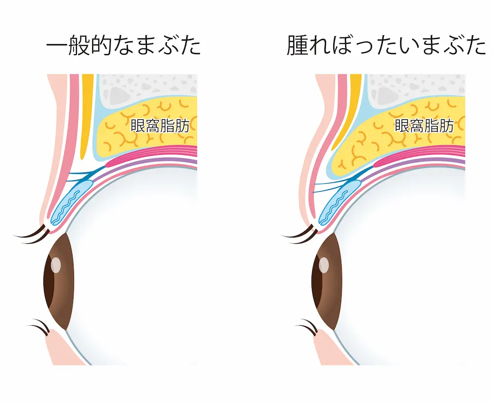 瞼の構造