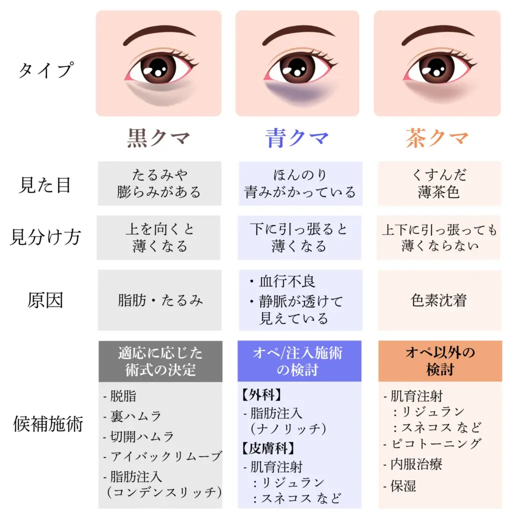 目の下のクマ取り・たるみ取り 主な種類と特徴