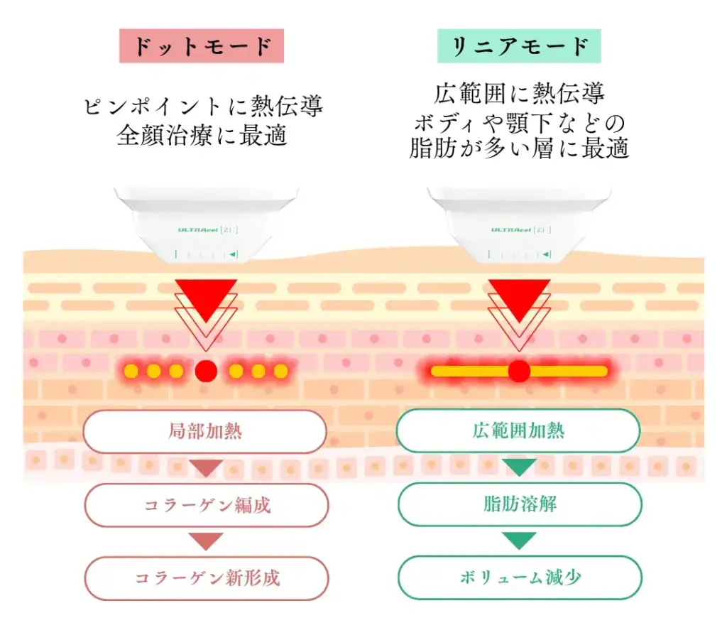ドットモードとリニアモードの違い
