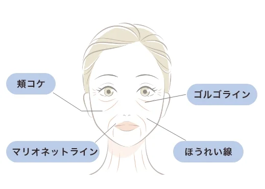 シワ・たるみ