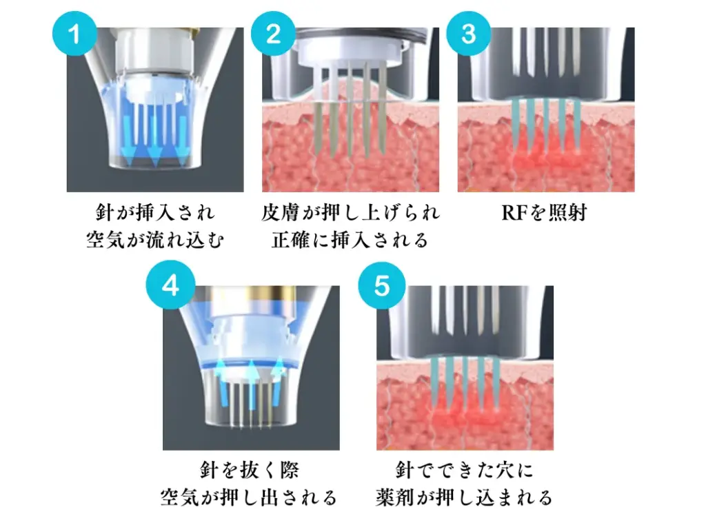 独自のドラッグデリバリーシステム