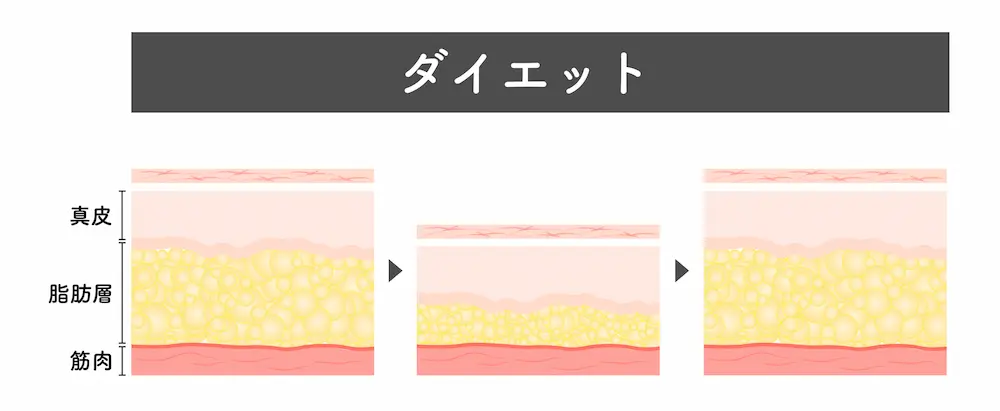 ダイエットによる脂肪の減少とリバウンド