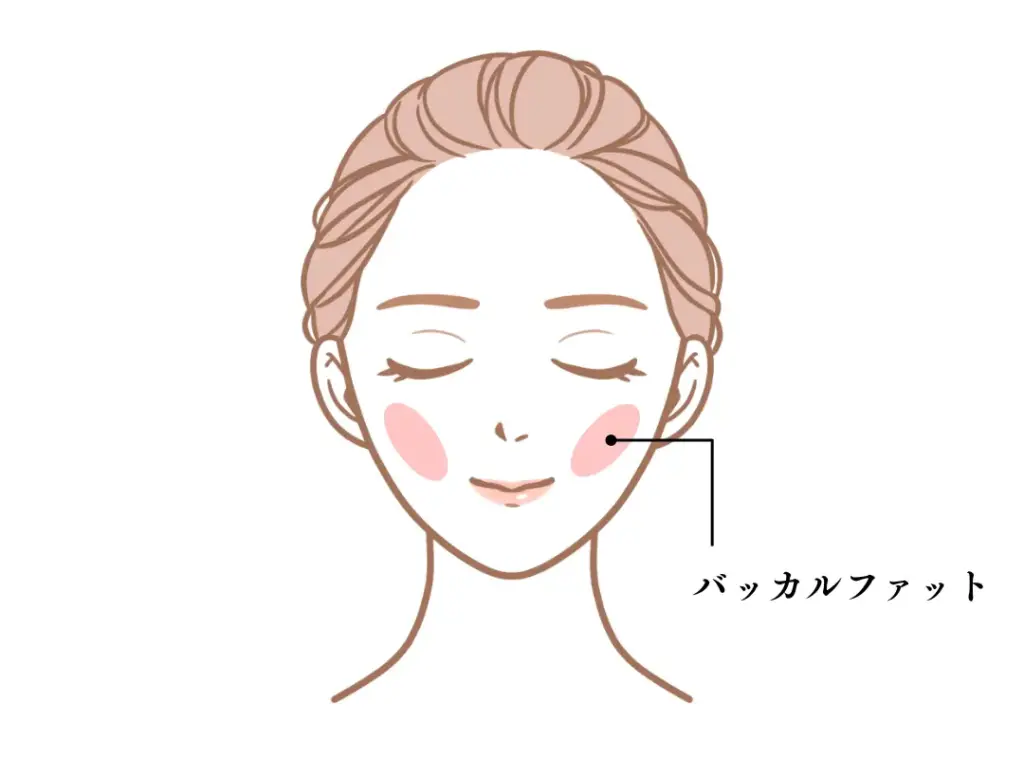 バッカルファット