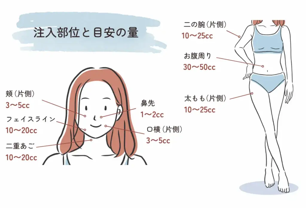 頬(片側):3〜5cc|フェイスライン:10〜20cc|二重あご:10〜20cc|鼻先1〜2cc|口横(片側):3〜5cc|二の腕(片側):10〜25cc|お腹周り30〜50cc|太腿(片側10〜25cc)