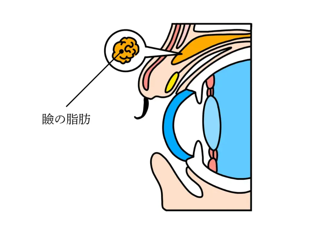 瞼の脂肪イメージ画像