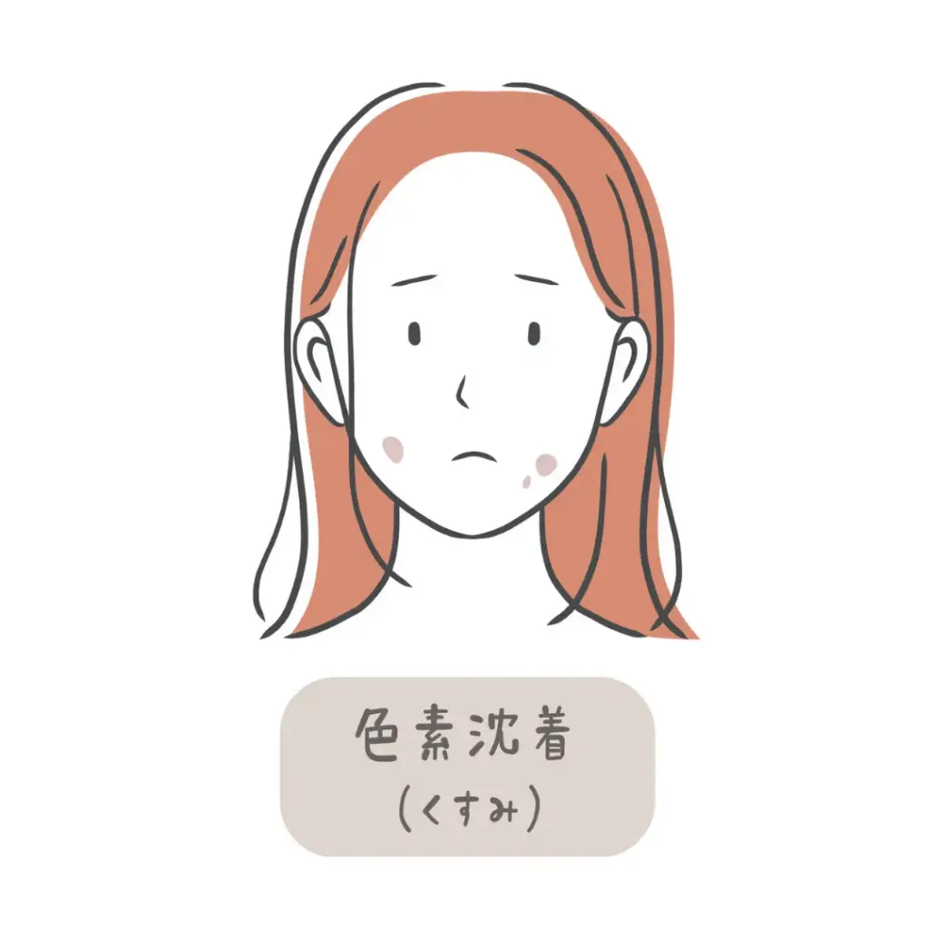 炎症後色素沈着