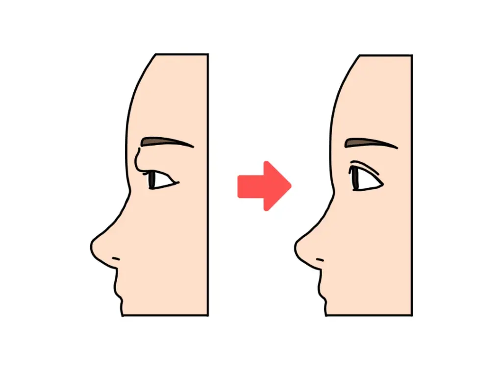 瞼の皮膚の厚さイメージ画像