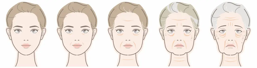 皮下脂肪の変化