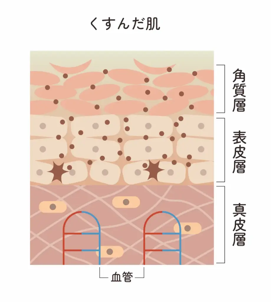 肌のくすみ・色素沈着の改善