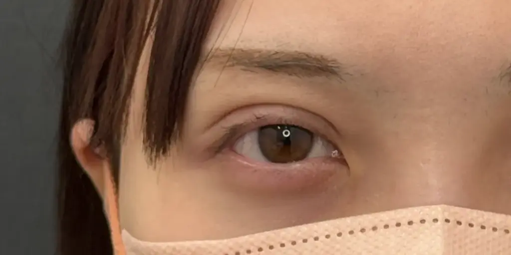 ハム目の画像
