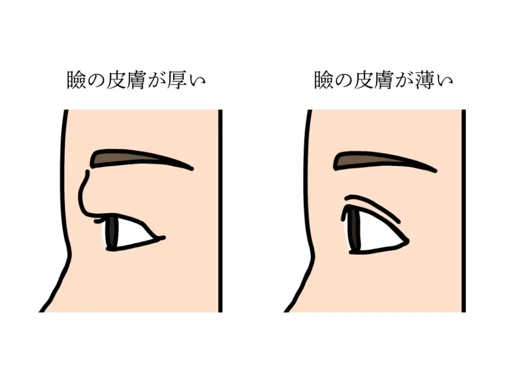 瞼の皮膚の厚さイメージ画像