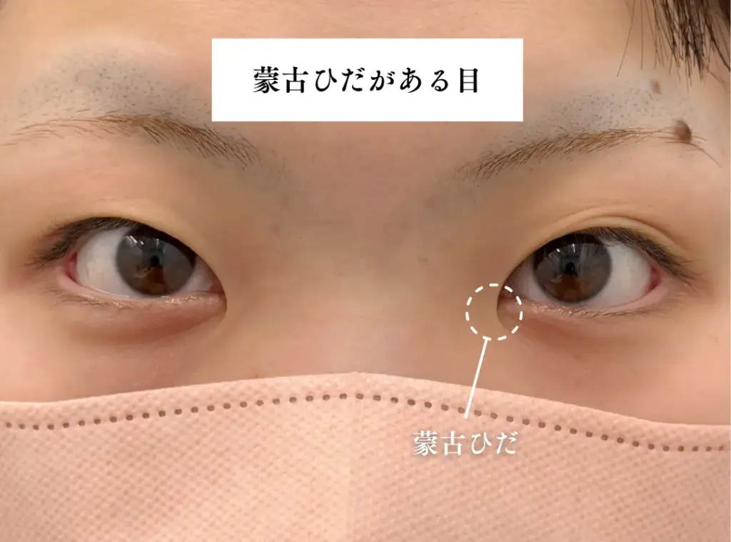 蒙古襞がある目