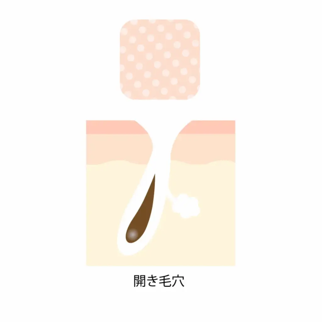 開き毛穴