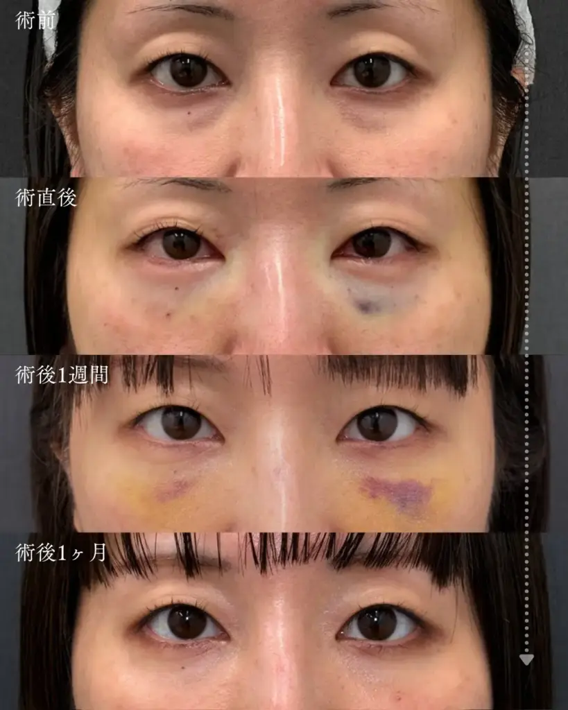 裏ハムラのダウンタイム