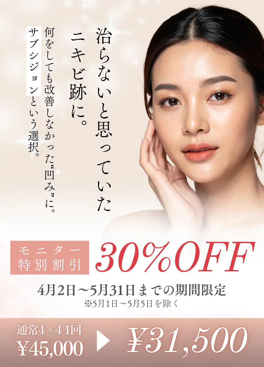 サブシジョンキャンペーン