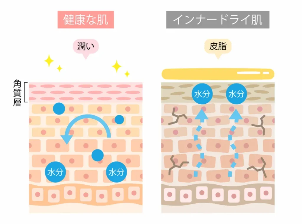 健康な肌とインナードライ肌の違い