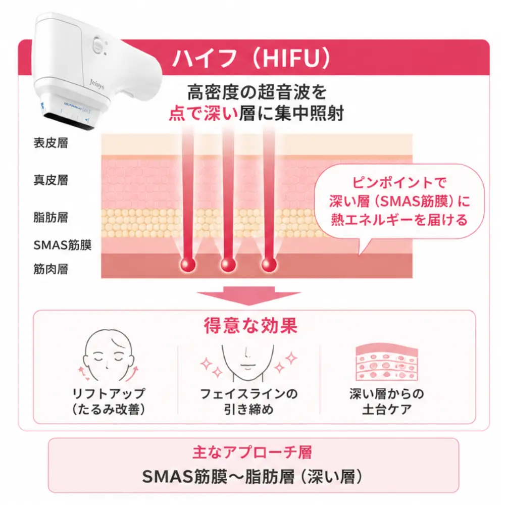 ハイフのイメージ