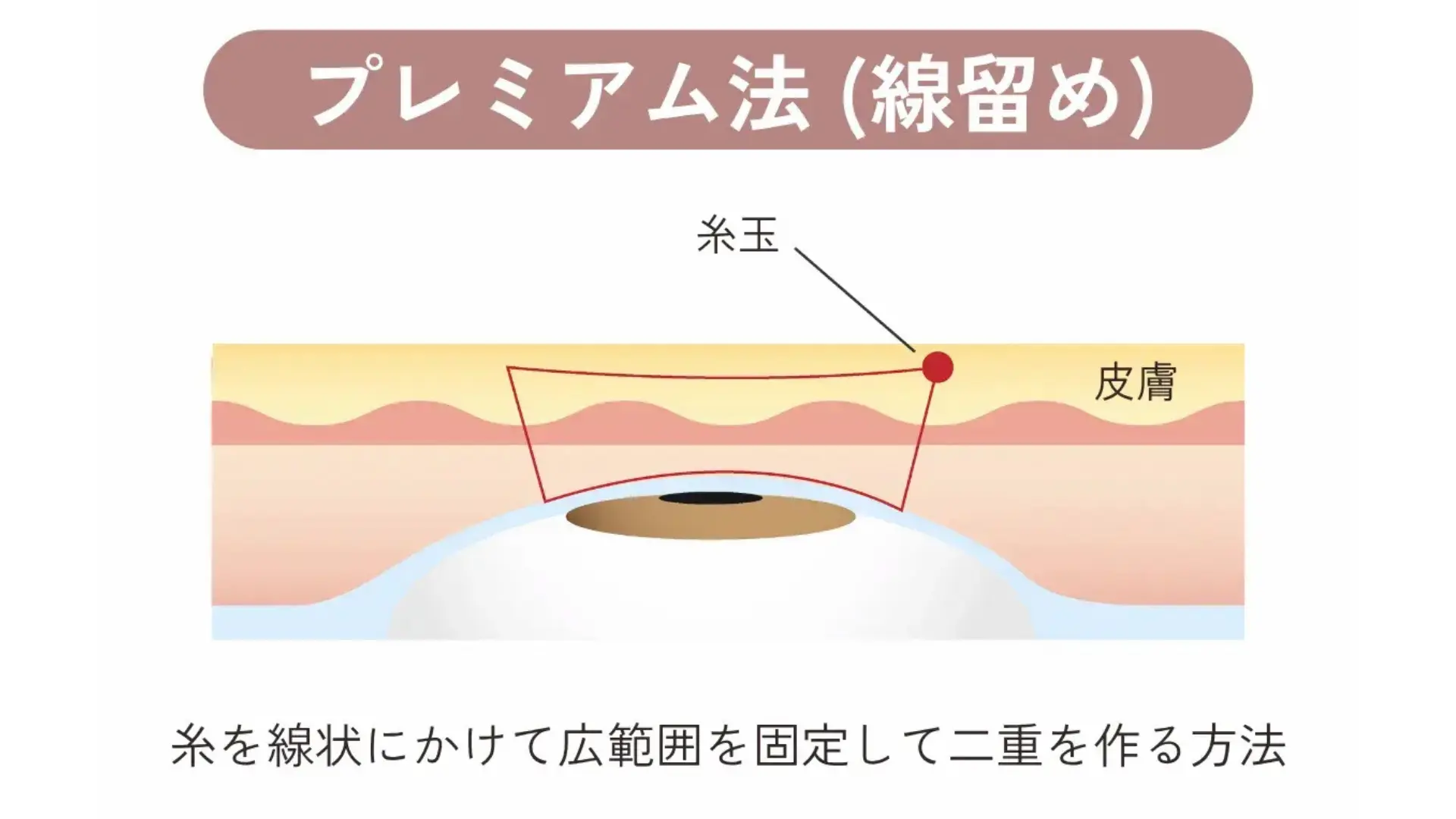 プレミアム法 施術イメージ