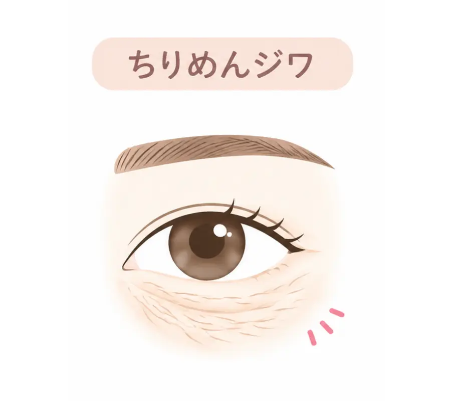 ちりめんジワのイメージ画像