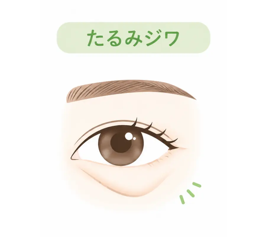たるみジワのイメージ画像