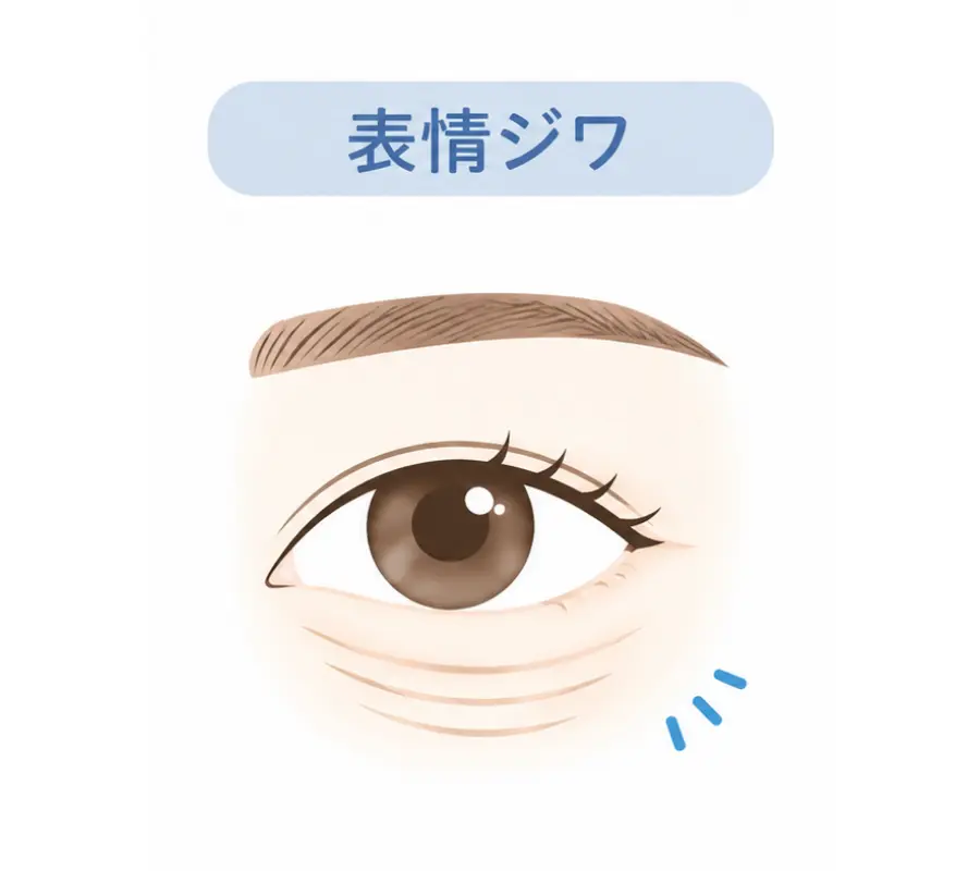 表情ジワのイメージ画像